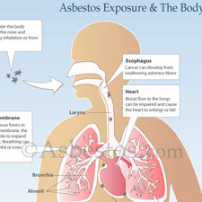 Asbestos Facts